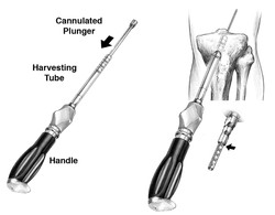 Cannulated Reamer