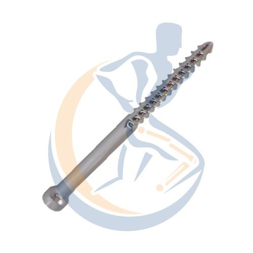 Stainless Steel 4.0 Mm Interlocking Bolt